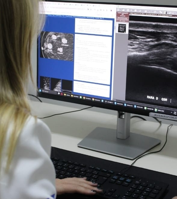 No momento, você está visualizando CDI da Santa Casa de Marília realiza mutirão de exames durante o Outubro Rosa. Ação beneficiou pacientes da Oncologia e colaboradoras do hospital. Confira